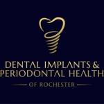 Dental Implants Periodontal Health