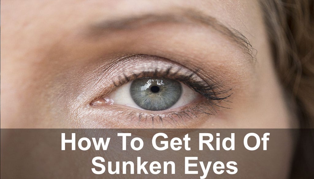 Sunken Eyes - How To Get Rid Of Sunken Eyes - Glowy Dowy