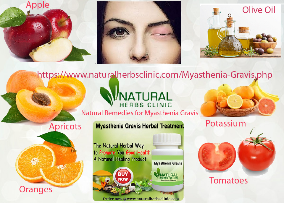 Read the Advantages of Natural Remedies for Myasthenia Gravis