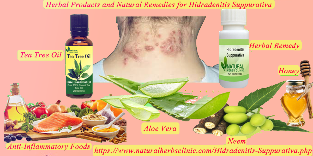 Herbal Products and Natural Remedies for Hidradenitis Suppurativa