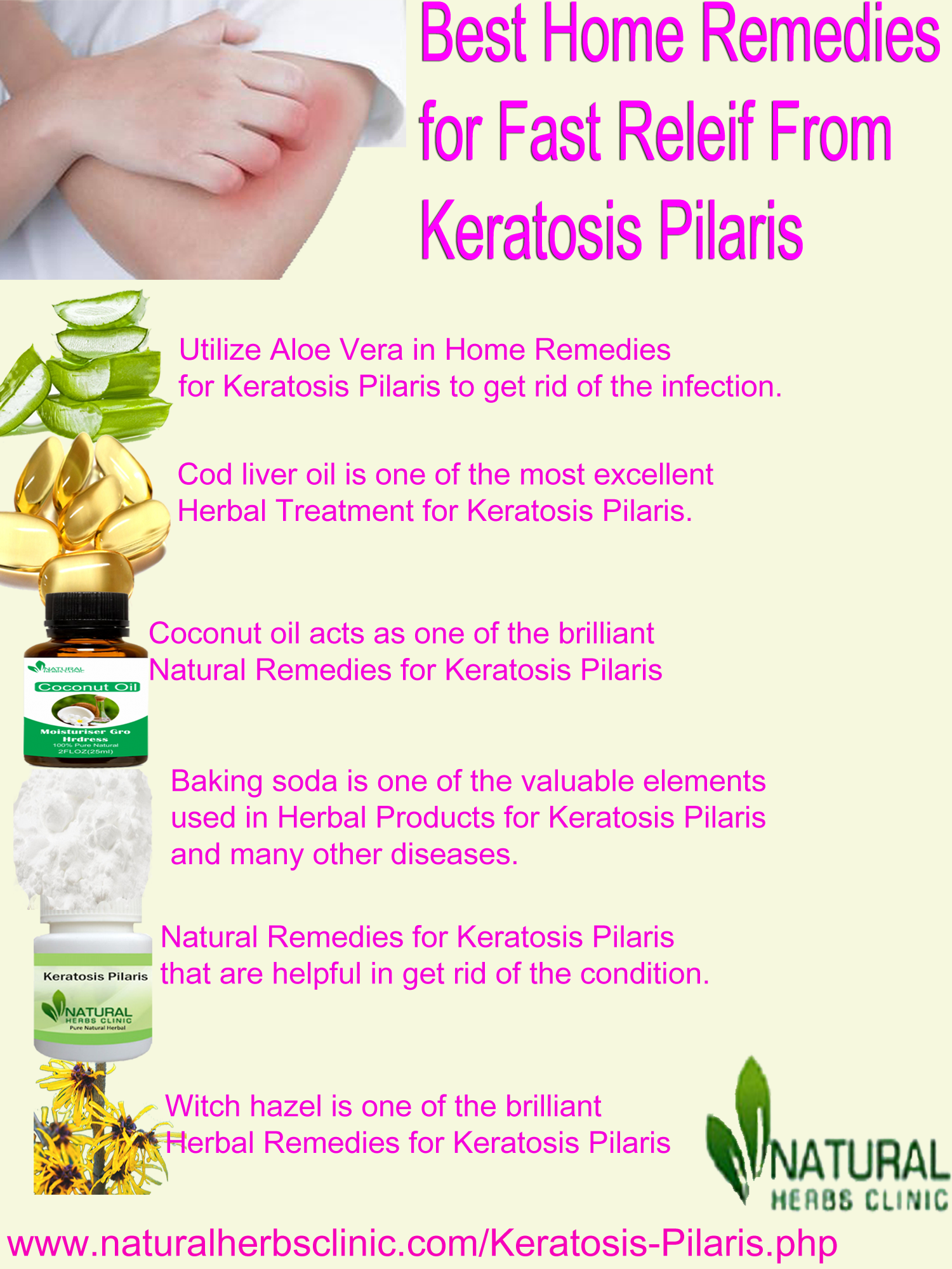 Natural Remedies to Stop the Keratosis Pilaris