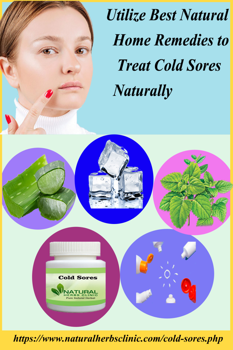 Best Home Remedies for Cold Sores