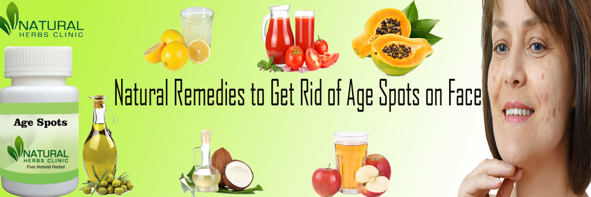 Natural Remedies to Get Rid of Age Spots on Face