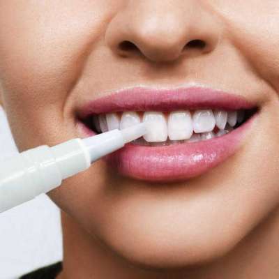 Teeth Whitening Pen, Vegan, Safe & Natural – Snow White Profile Picture
