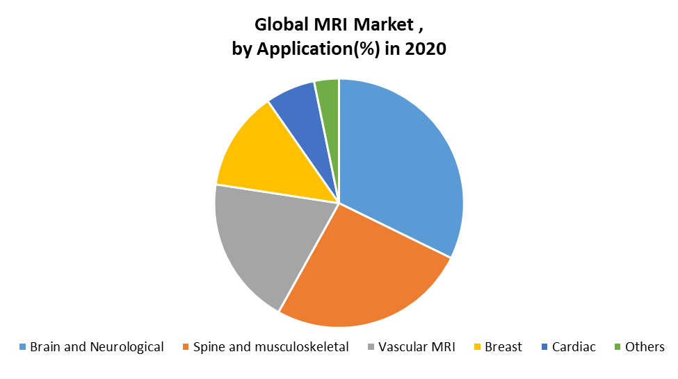 Global MRI Market: Industry Analysis and Forecast (2021-2027)