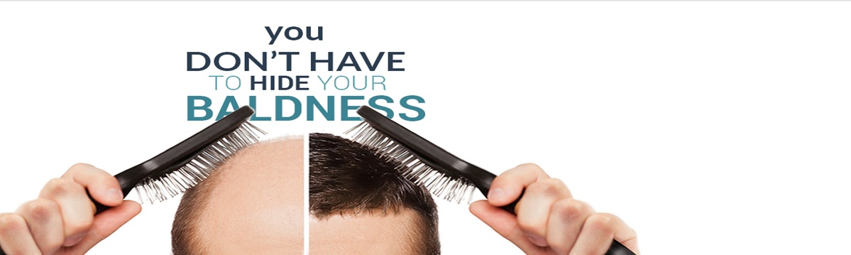 Hair Patch in Delhi | Hair Patch Rate in Delhi