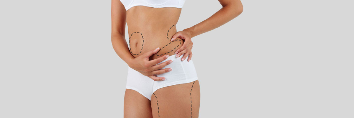 Can Liposuction Help Me Lose Weight?
