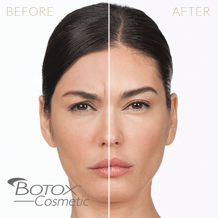Botox Plantation | Neurotoxin | Wrinkle Reduction | The Vera Medical Institute