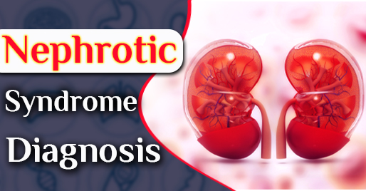 How can Nephrotic Syndrome diagnosis help in acquiring the best treatment in a child? - Kidney and ayurveda