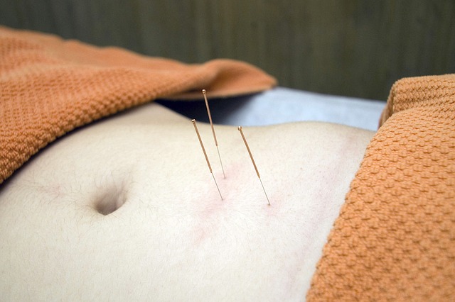 Everything to know about Acupuncture for Pain in Morristown