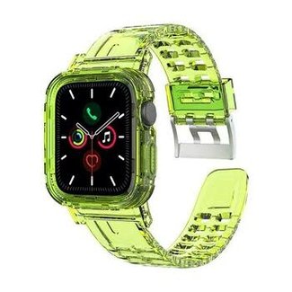 Reason to Choose the Best Shop for Apple Watch Bands