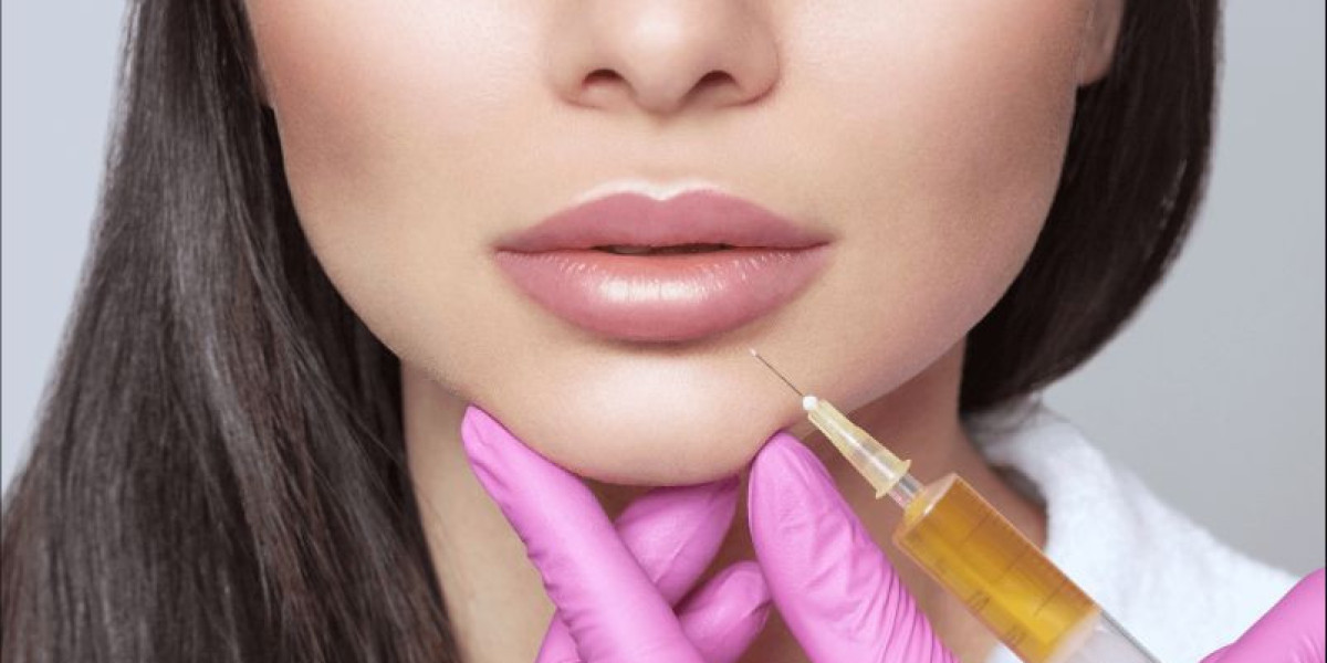 Give Your Lips a Stunning Look with Restylane Line Injections in NYC