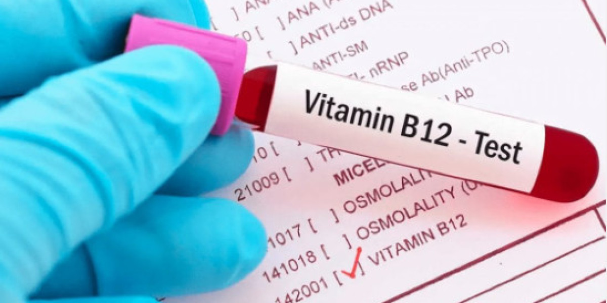 Ensure Accessible Healthcare With Affordable Vitamin B12 Test Prices