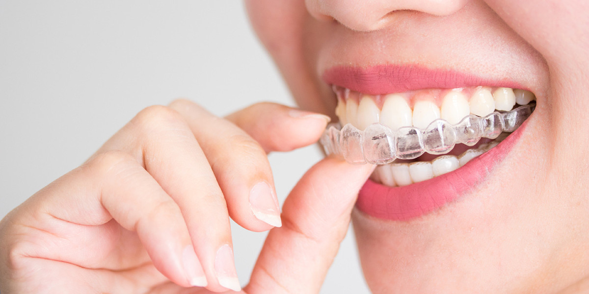 best invisalign Auckland