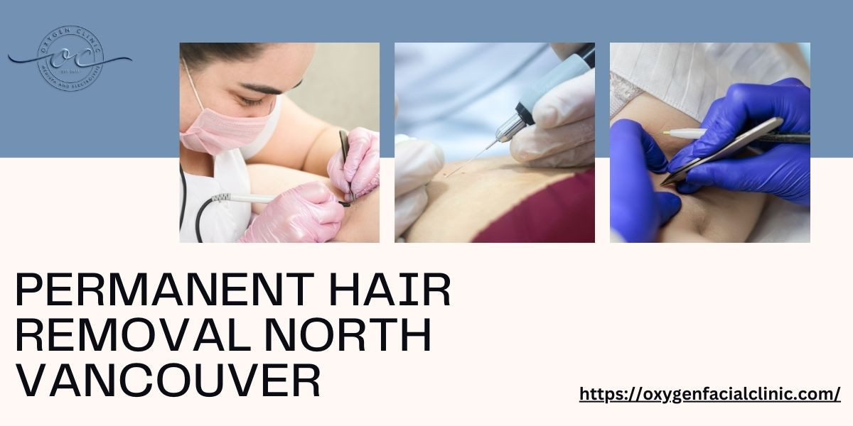 Different Popular Methods Of Permanent Hair Removal