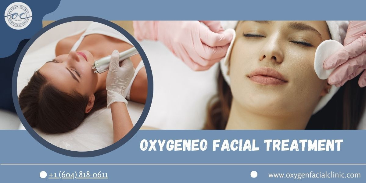 Rejuvenate Your Skin With The Oxygeneo Facial Treatment