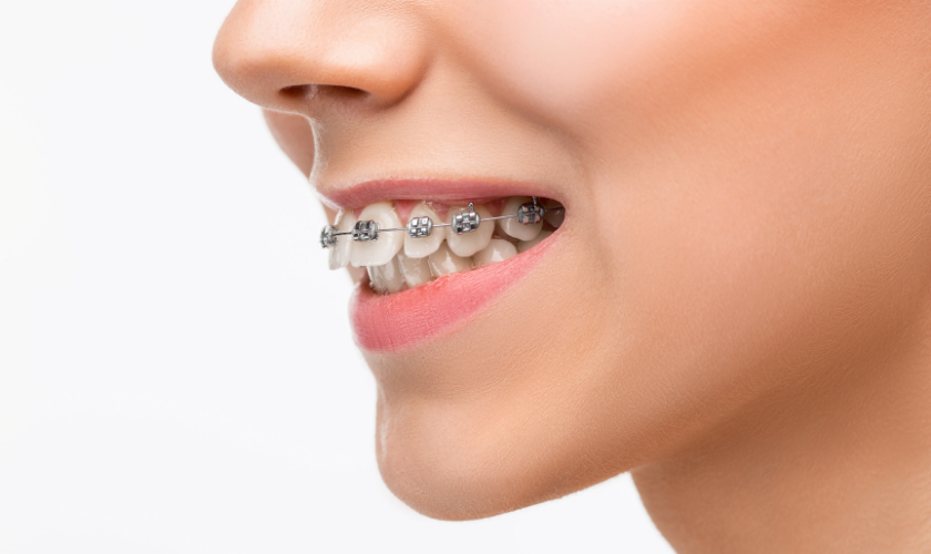 How Can Orthodontic Treatment Be Assisted?