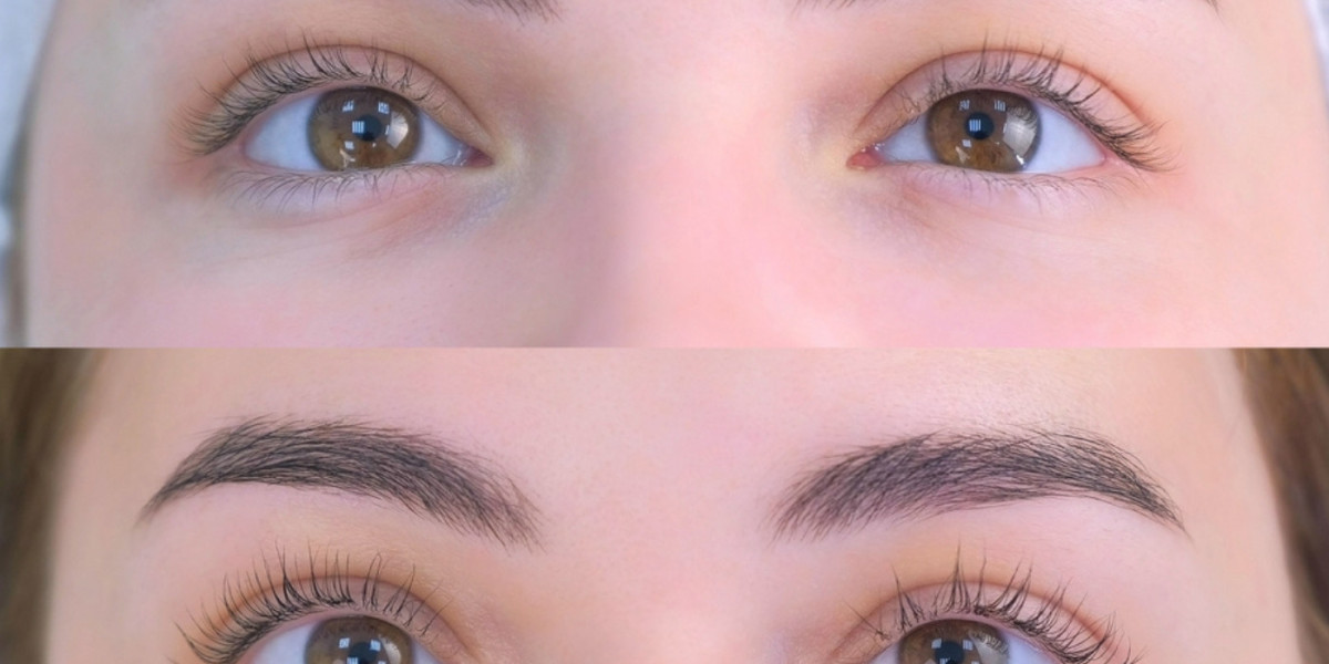 Does Lash Lift and Tint Make Lashes Fall Out?