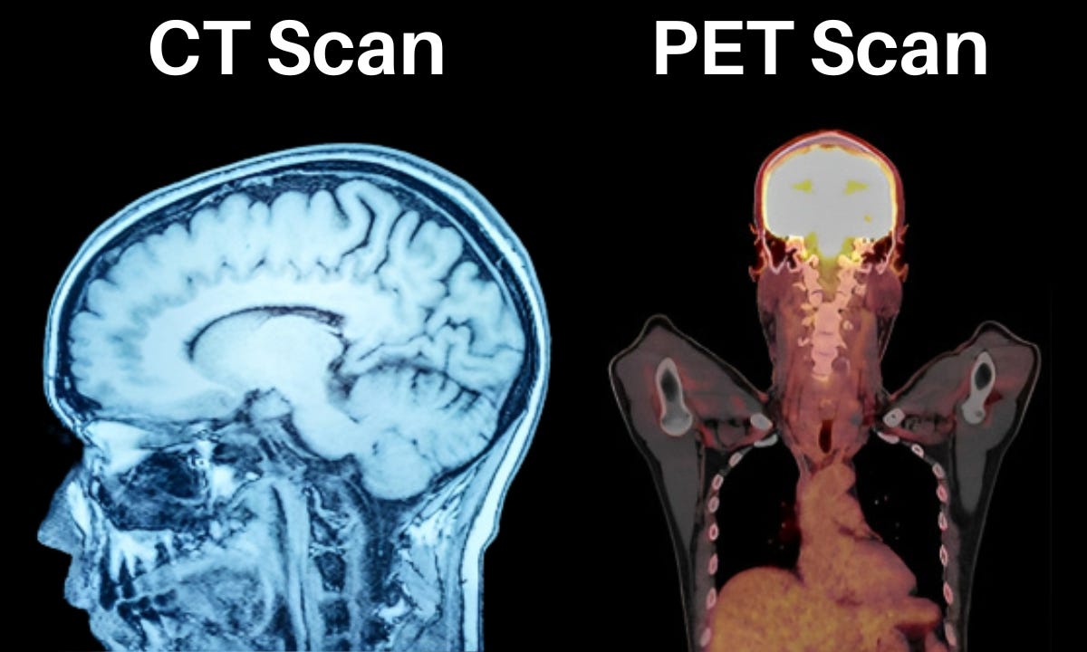 Understanding The Differences Between Ct Scans And