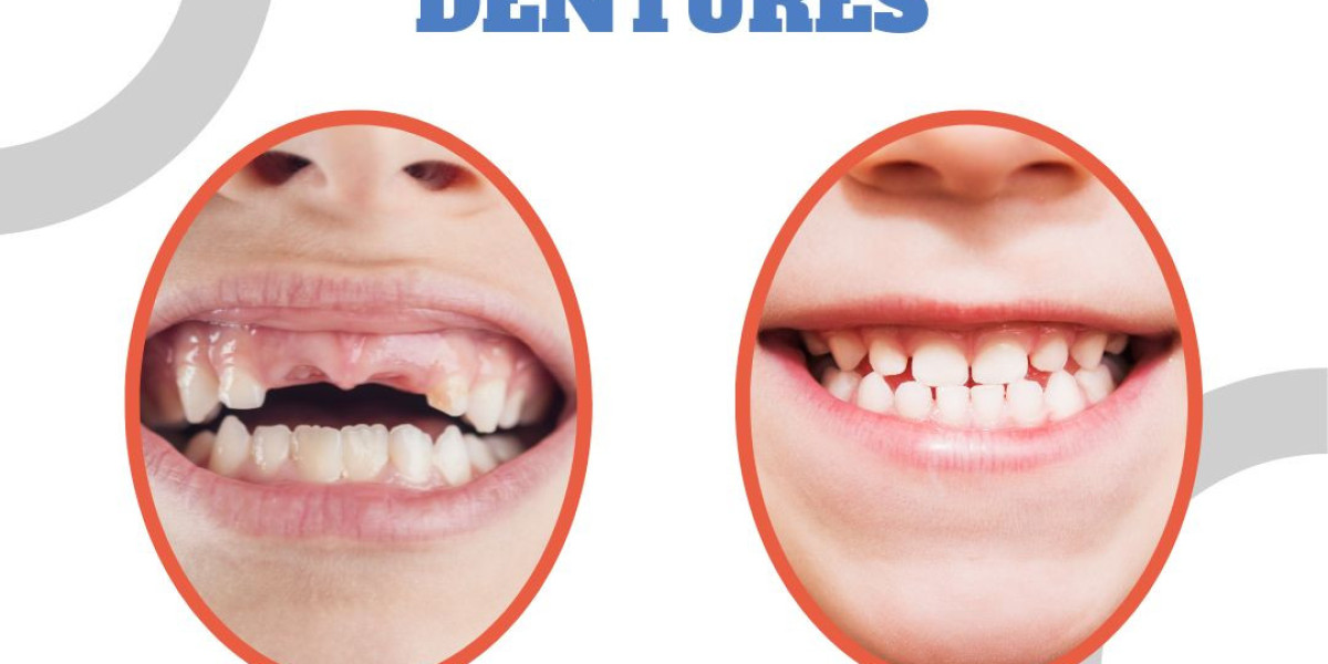 Transform Your Smile with Dentures in Richmond