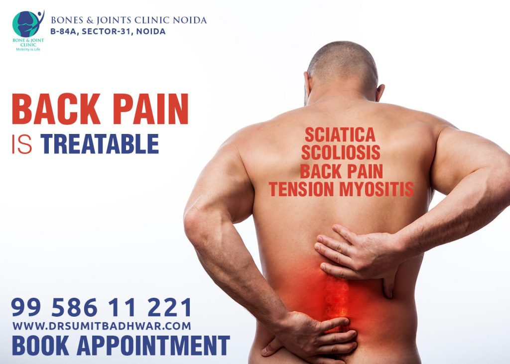 Looking for Back Pain Treatment? Here is Everything you need to know about it. – Dr Sumit Badhwar