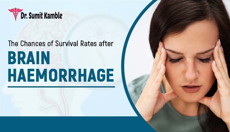 The Chances of Survival Rates After Brain Hemorrhage
