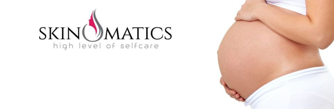 skino matics Cover Image