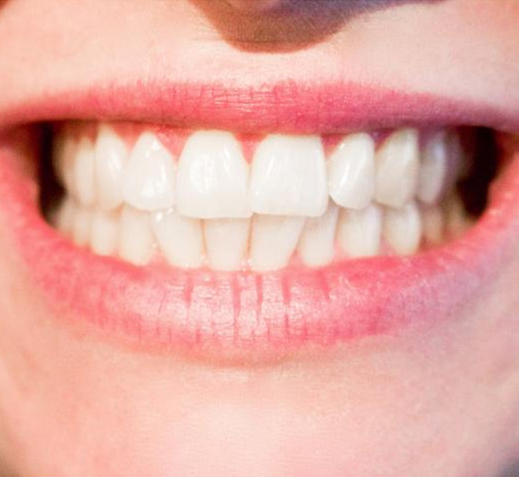 Holistic Dental Donvale on Tumblr: Explore Cosmetic Dentistry and Sleep Dentistry in Donvale