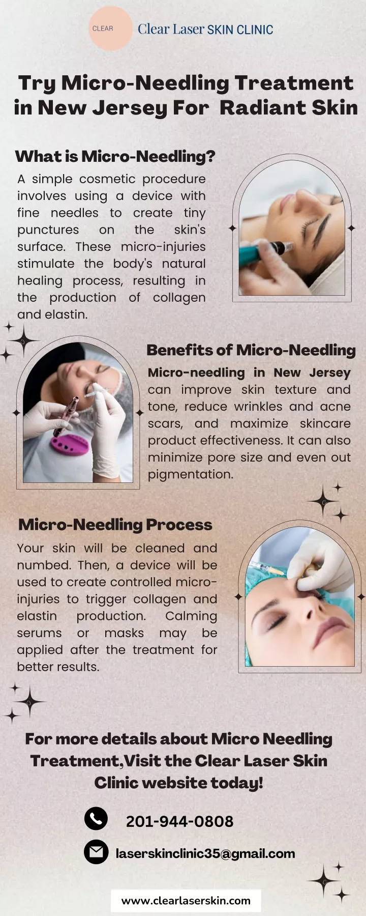 PPT - Try Micro-Needling Treatment in New Jersey For Radiant Skin ! PowerPoint Presentation - ID:13050283