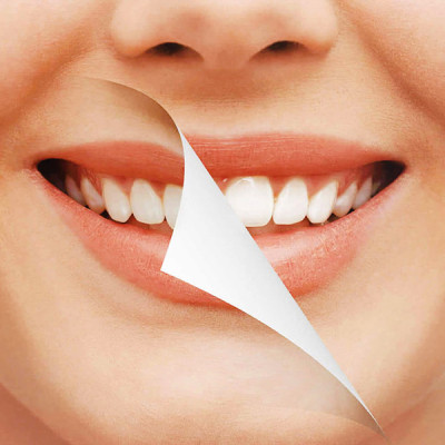 Crest Teeth Whitening Strips Profile Picture