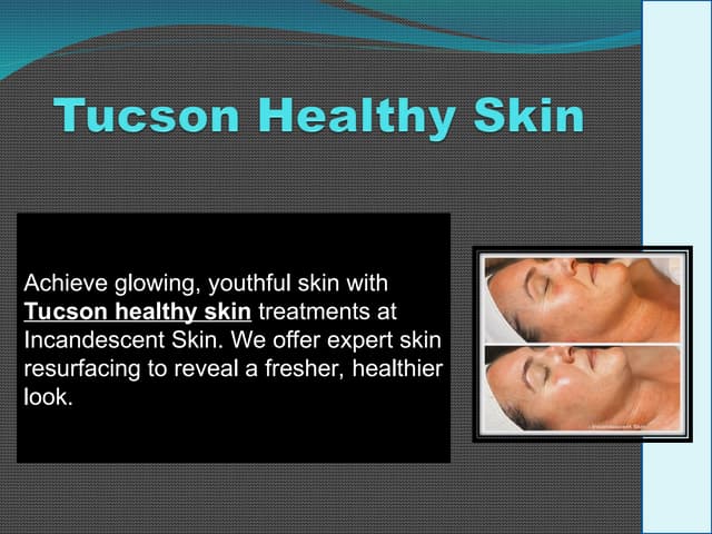 Tucson Healthy Skin | PPT