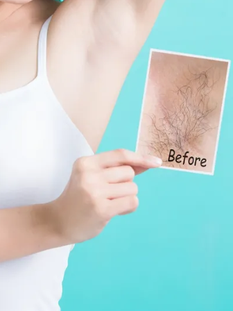 Benefits Of Laser Hair Removal | Article Terrain