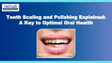 Teeth Scaling and Polishing Explained A Key to Optimal Oral Health