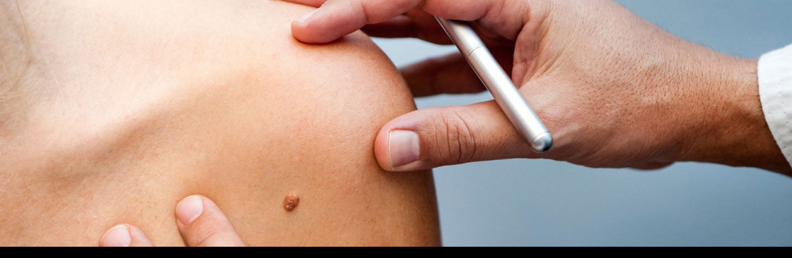 Mole Check Clinic Cover Image