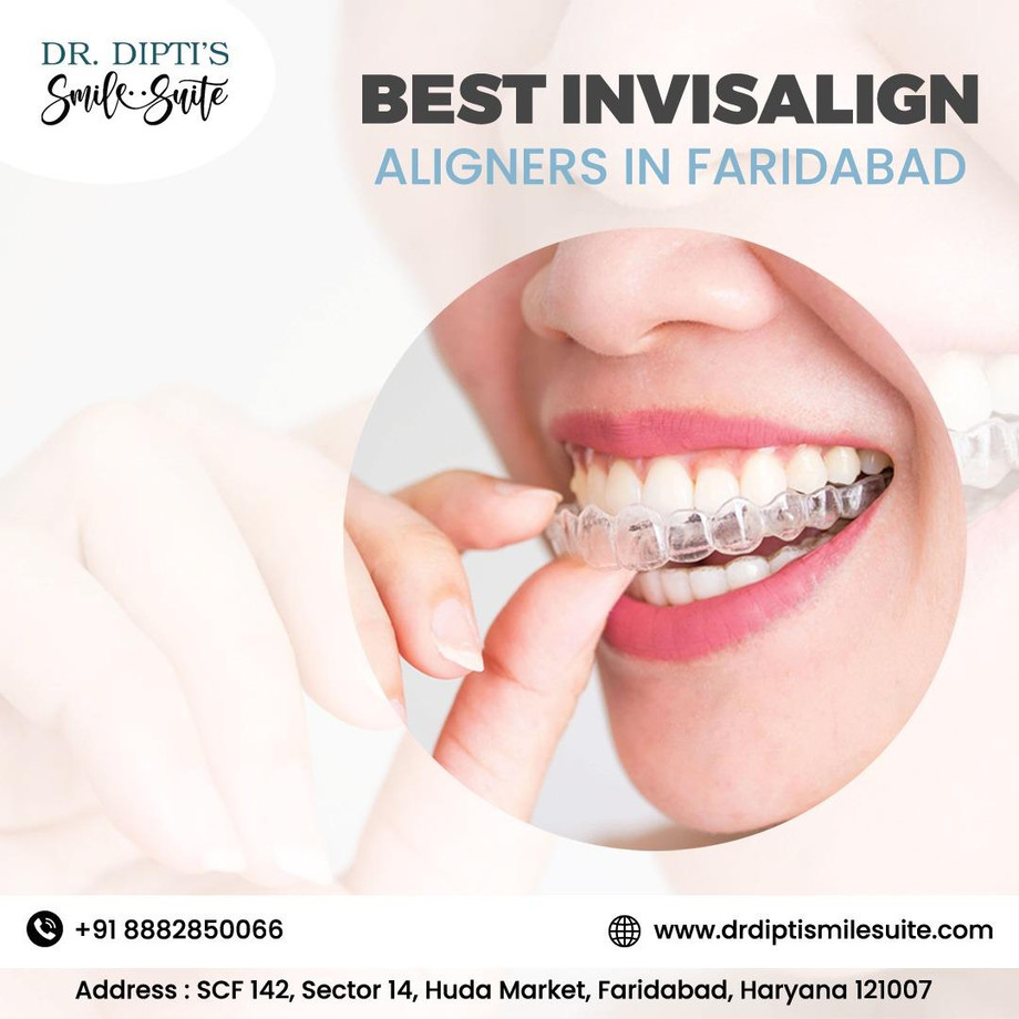 Best Invisalign Aligners in Faridabad - JustPaste.it