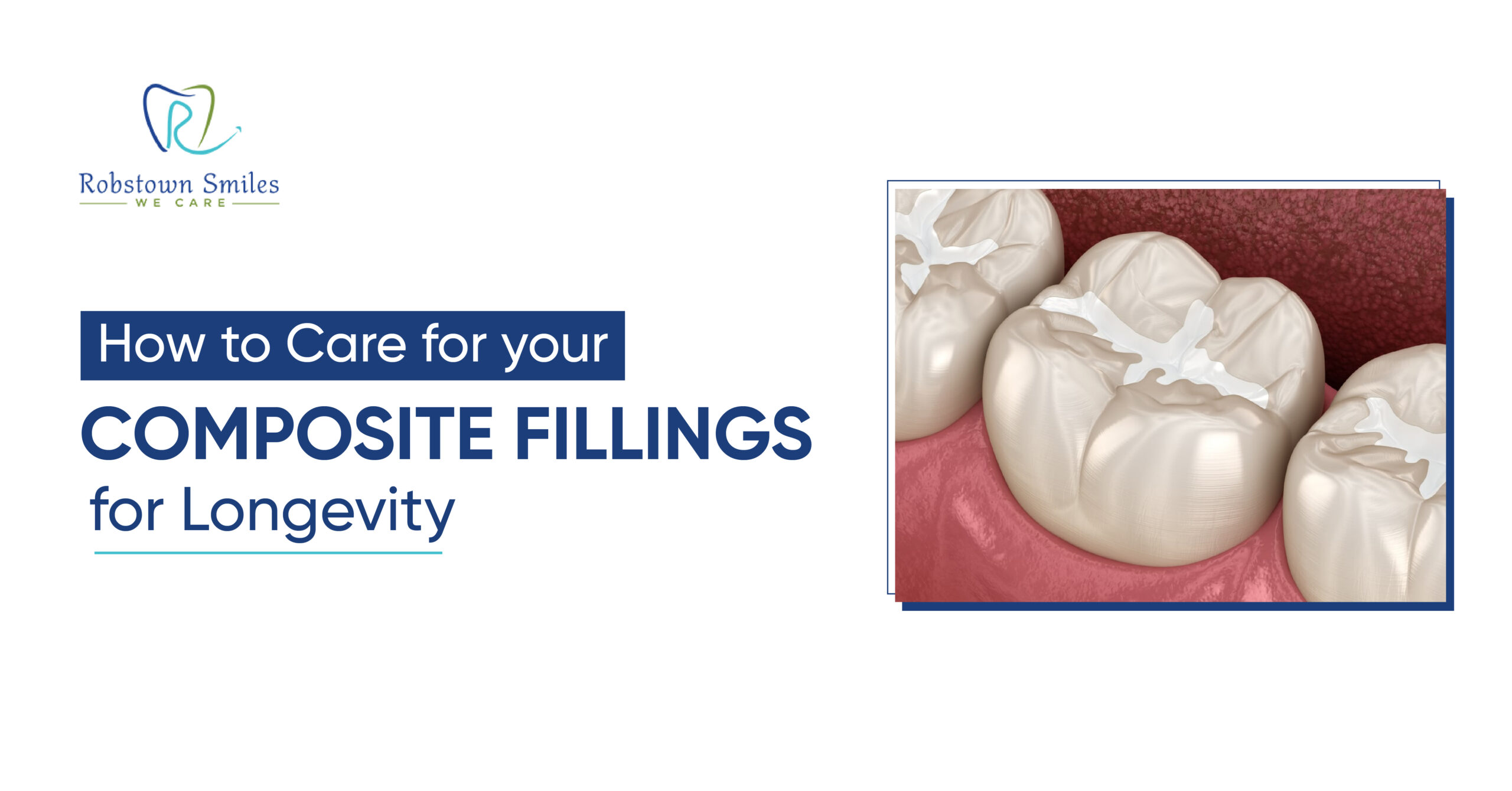 How to Care for Composite Fillings for Long-Lasting Results