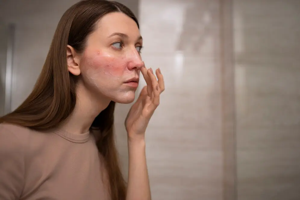 Winter Skin Problems and How Spa Treatments Can Solve Them